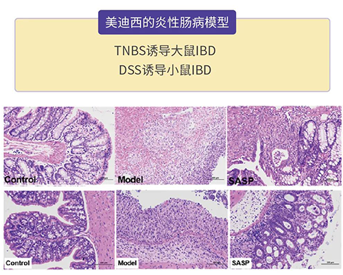 合乐HL8的炎症性肠病模型
